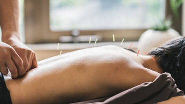 acupuncture_weight_loss_posthead