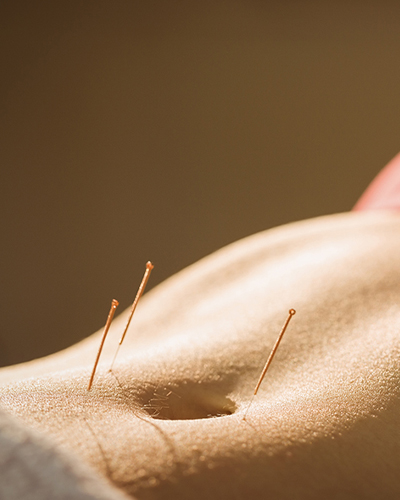 home page fertility acupuncture